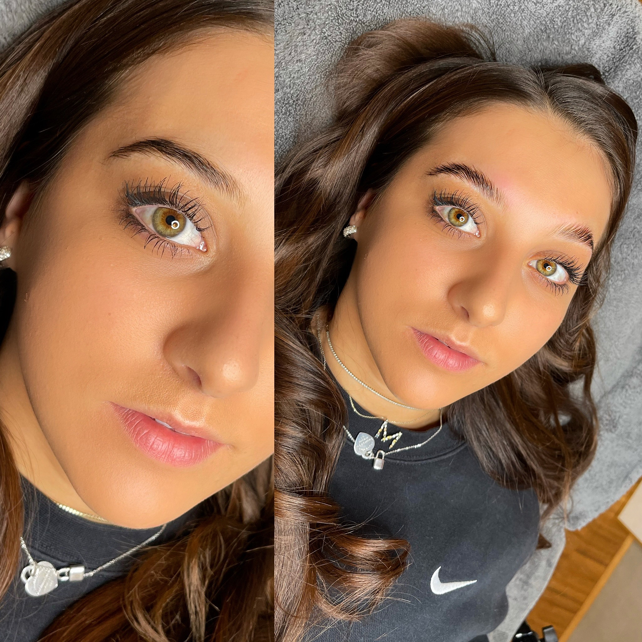 BROWLIFTING